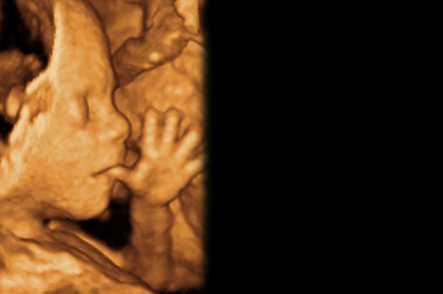 Almamed | Ambulatorio di Ostetricia e ginecologia - Diagnosi prenatale